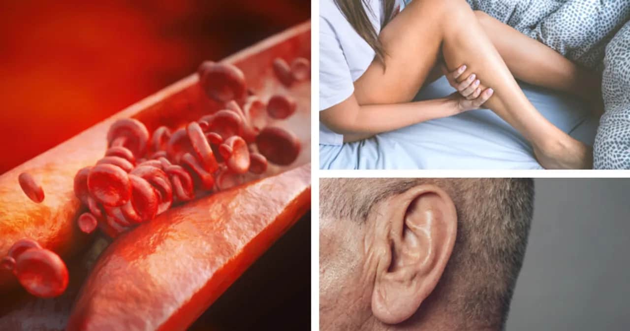 Miażdżyca objawy psychiczne: Jak choroba wpływa na Twoje zdrowie psychiczne?